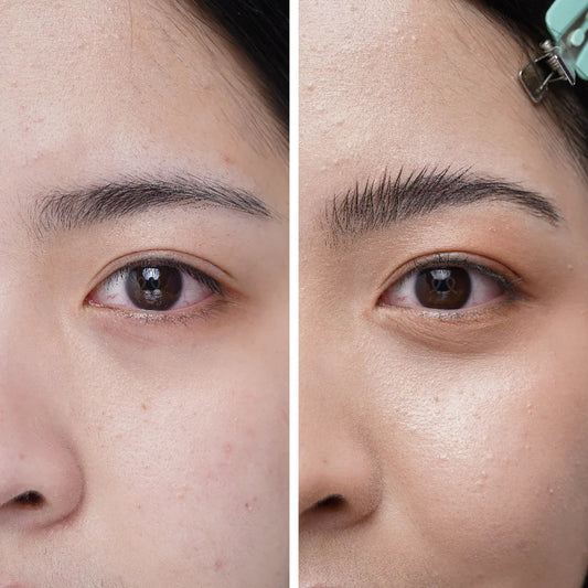 hasil natural penggunan brow lift kit