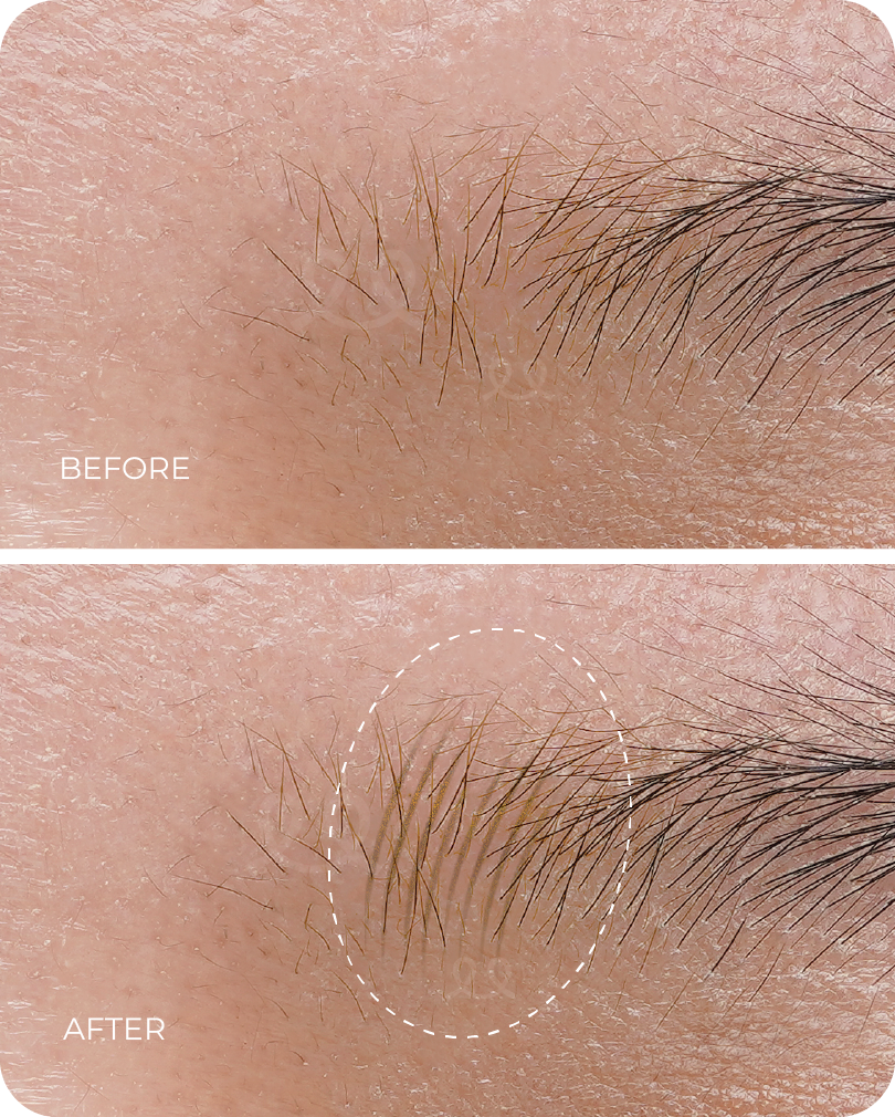 Bundle ForLines Franky Wu x Hibrow x FineLine (Wood)